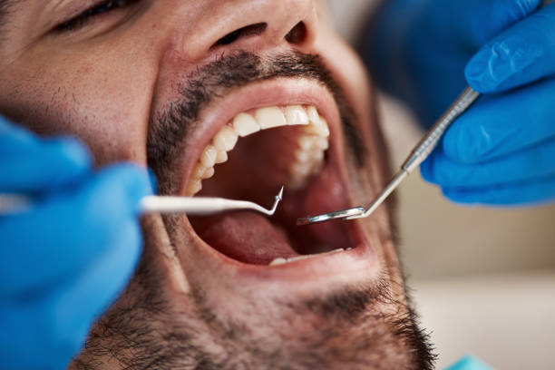 Best Knocked-Out Tooth Emergency  in Otsego, MN